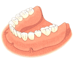 総入れ歯とインプラントの比較